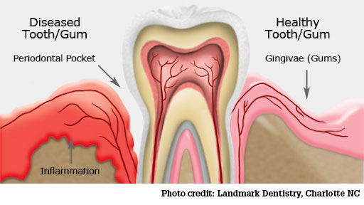 dental-health
